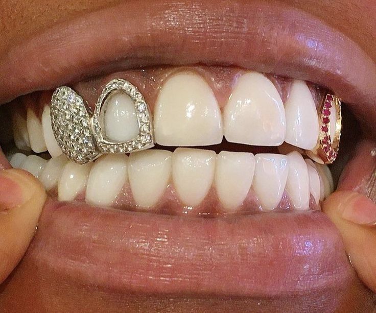 Dual Iced Tooth and Arrow Heart Grill