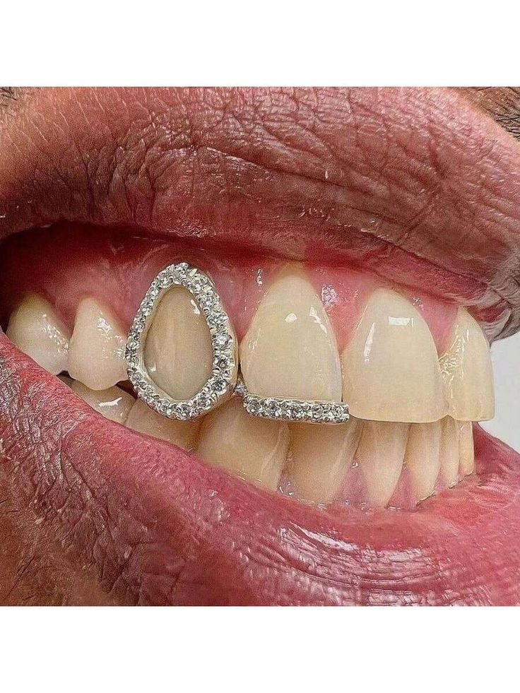 Dual Iced Hollow Tooth and Bar Grill