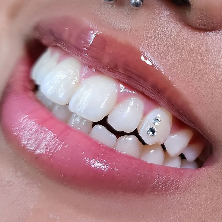 ICEDUP Tooth Gem Starter Kit