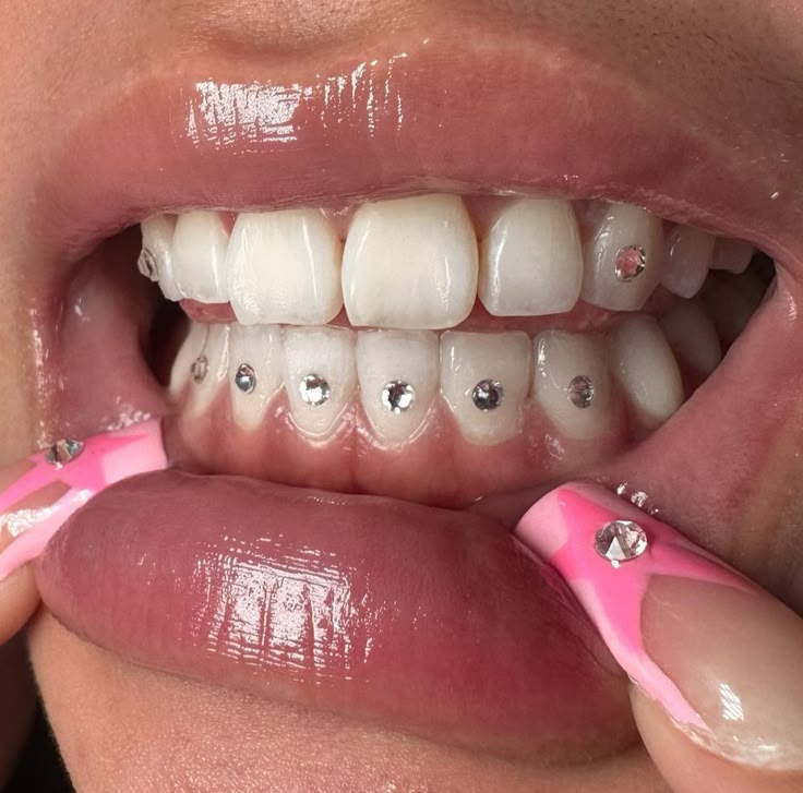 ICEDUP Tooth Gem Starter Kit
